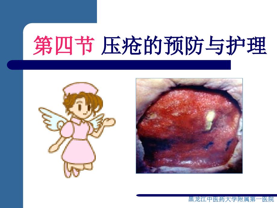 压疮的预防和护理PPT课件.ppt_第1页