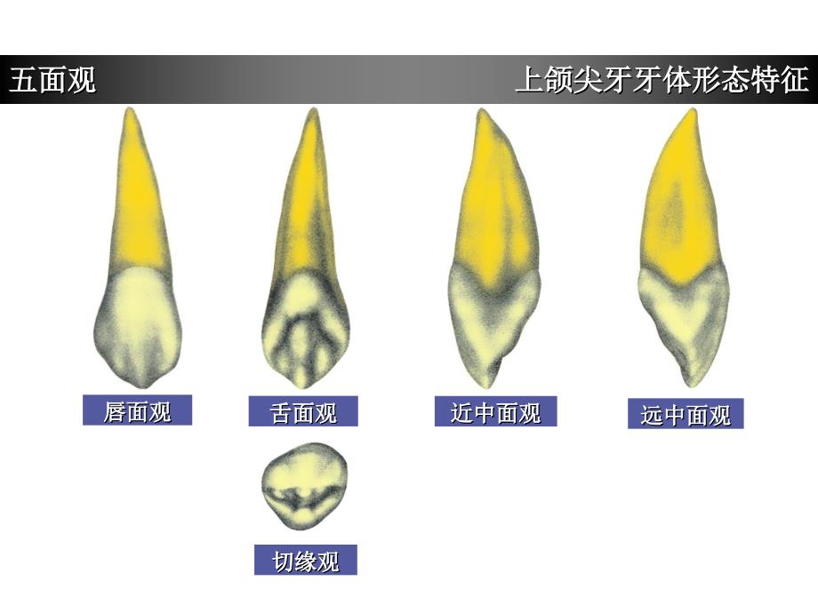 上颌尖牙牙体形态简述.ppt_第2页
