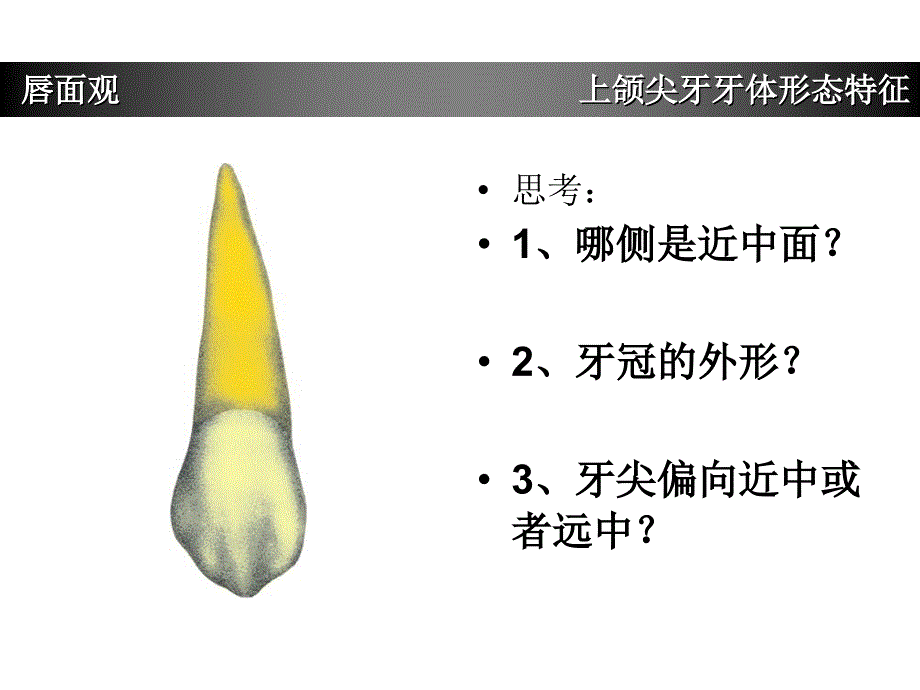 上颌尖牙牙体形态简述.ppt_第3页
