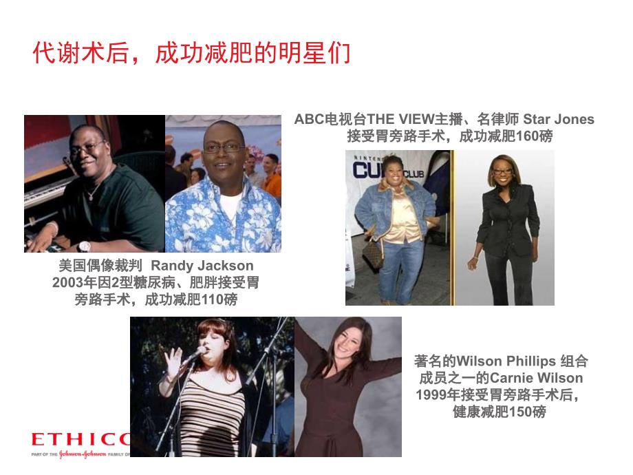减肥及代谢手术PPT课件.ppt_第3页