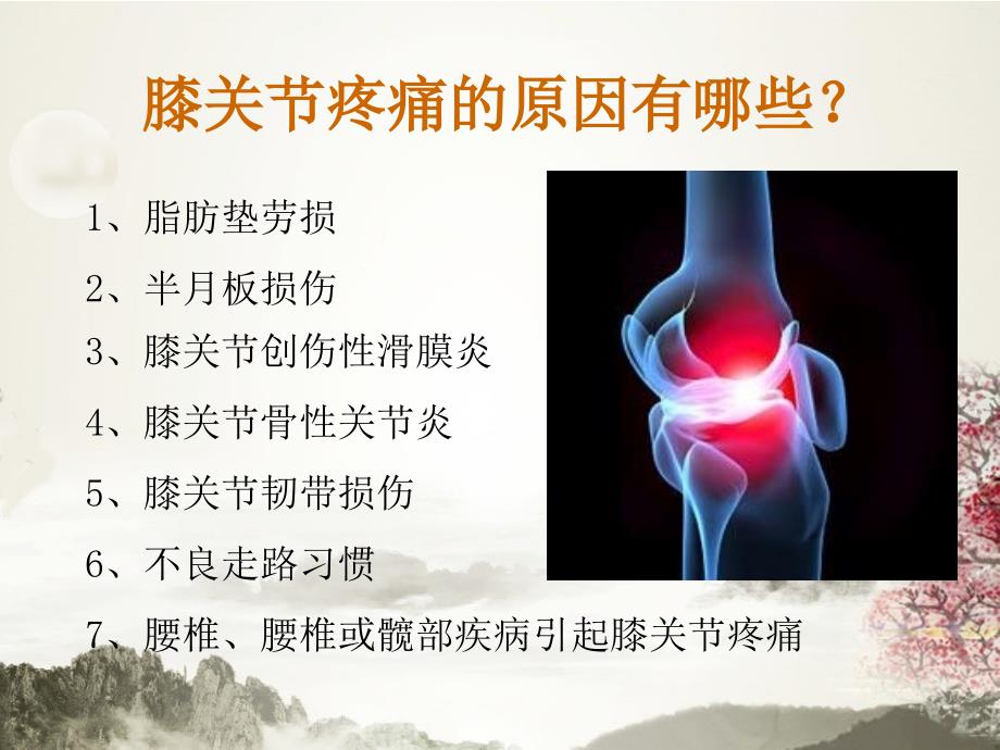 中医防治膝关节炎PPT课件.ppt_第3页