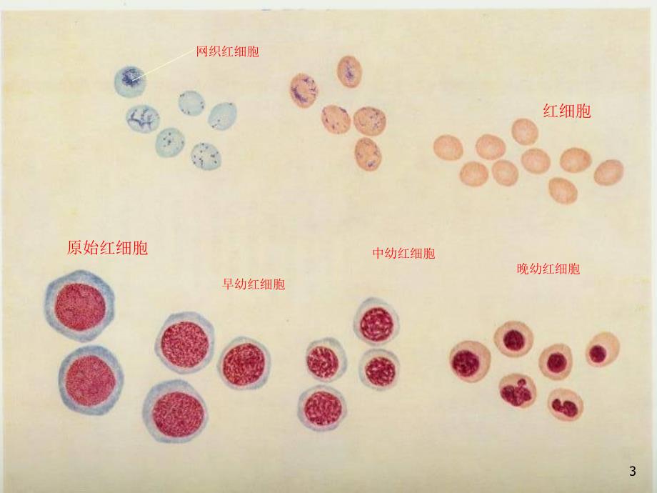 儿科学造血系统ppt课件.ppt_第3页