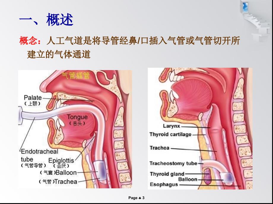 优质课件人工气道管理新进展.ppt_第3页