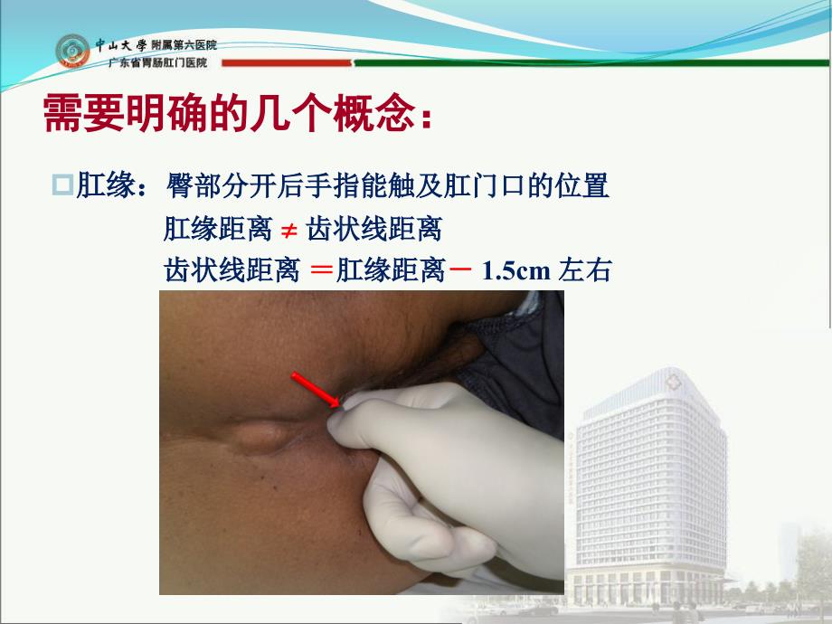 低位直肠癌术式选择及技巧.ppt_第2页