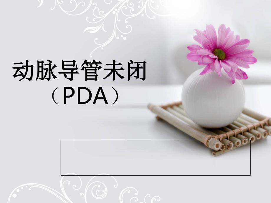 动脉导管未闭PPT课件.ppt_第1页