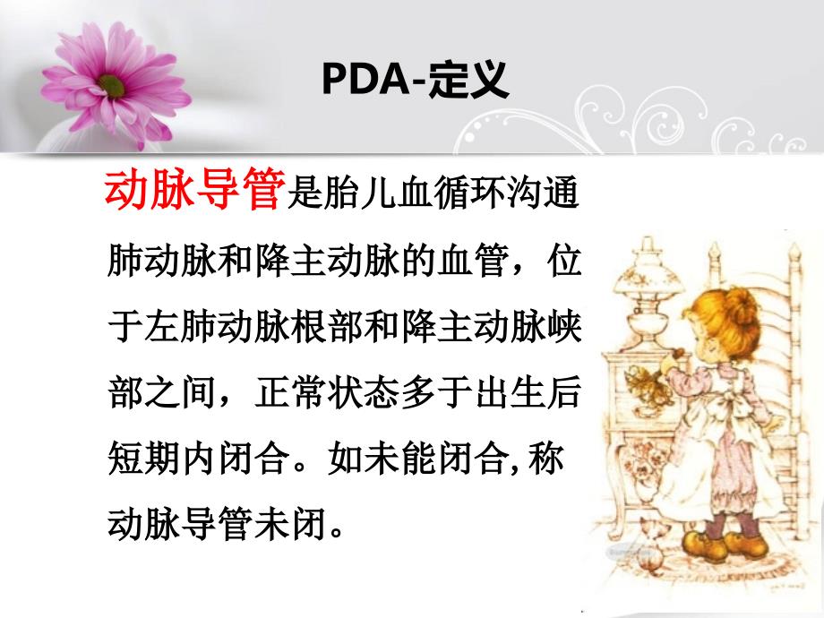 动脉导管未闭PPT课件.ppt_第2页