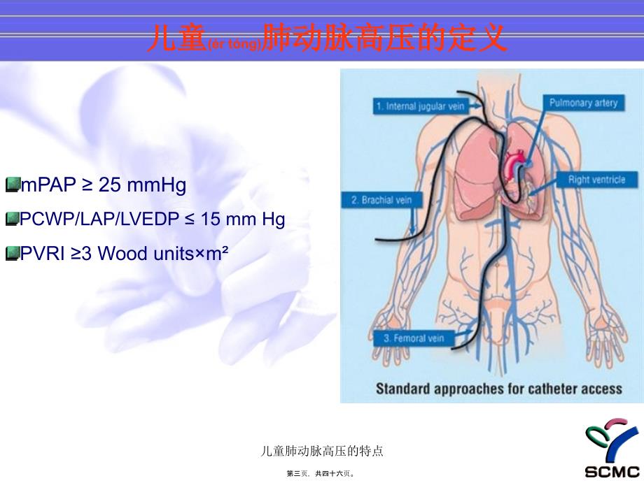 儿童肺动脉高压的特点课件.ppt_第3页