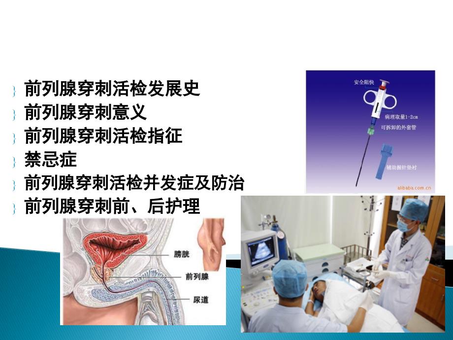 前列腺穿刺活检.ppt_第2页