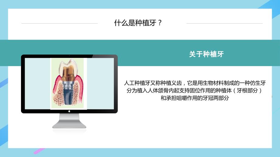 口腔种植手术护理流程.ppt_第3页