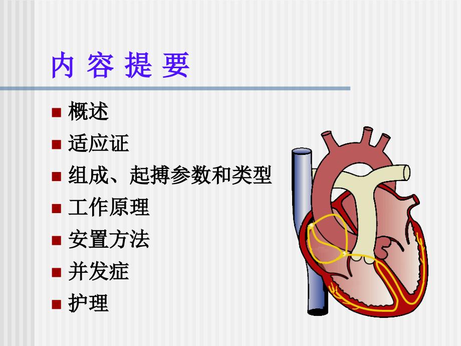 临时起搏器护理.ppt_第2页