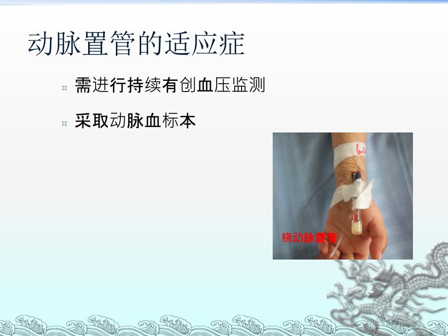 动静脉置管讲解.ppt_第3页
