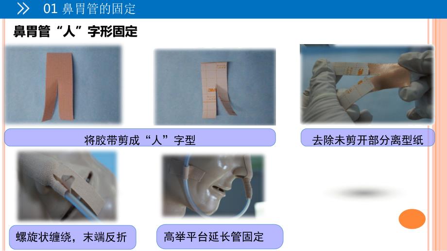各种常见留置管道的固定方法课件.ppt_第3页
