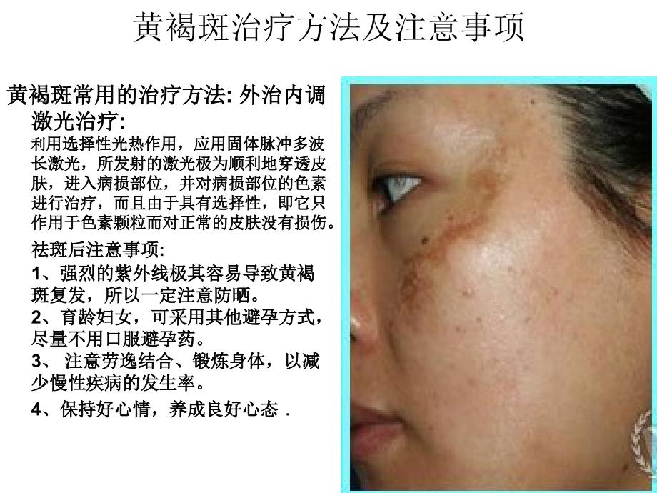各种斑的分类PPT课件.ppt_第3页