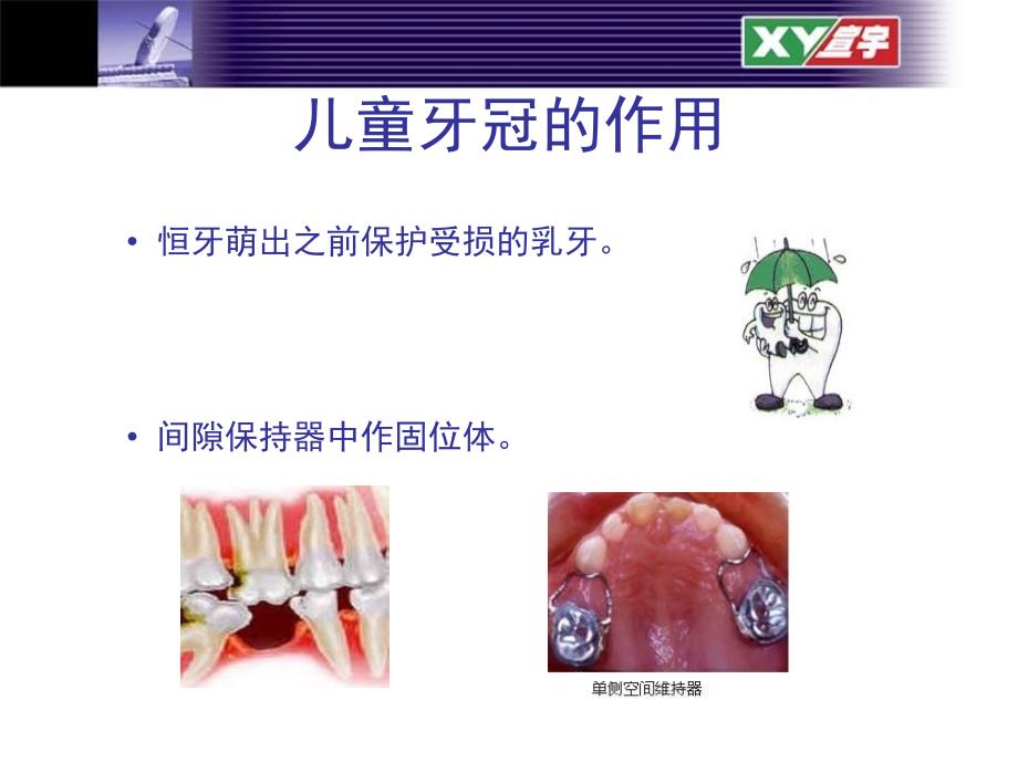 儿童不锈钢乳牙预成冠.ppt_第3页