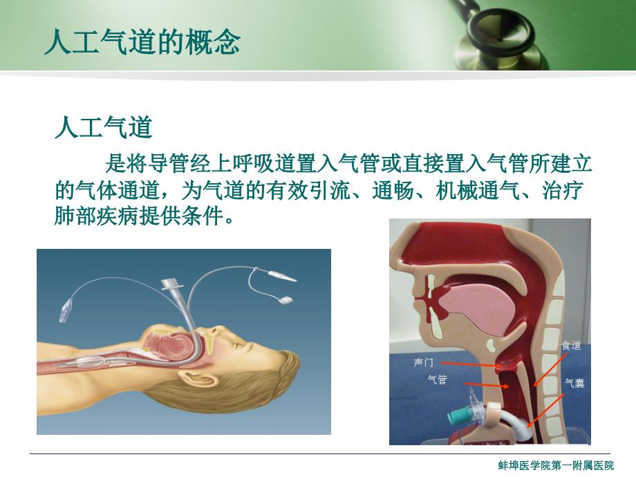 人工气道管理PPT课件.ppt_第2页