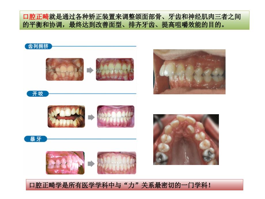 口腔正畸的生物力学和生物学基础.ppt_第2页