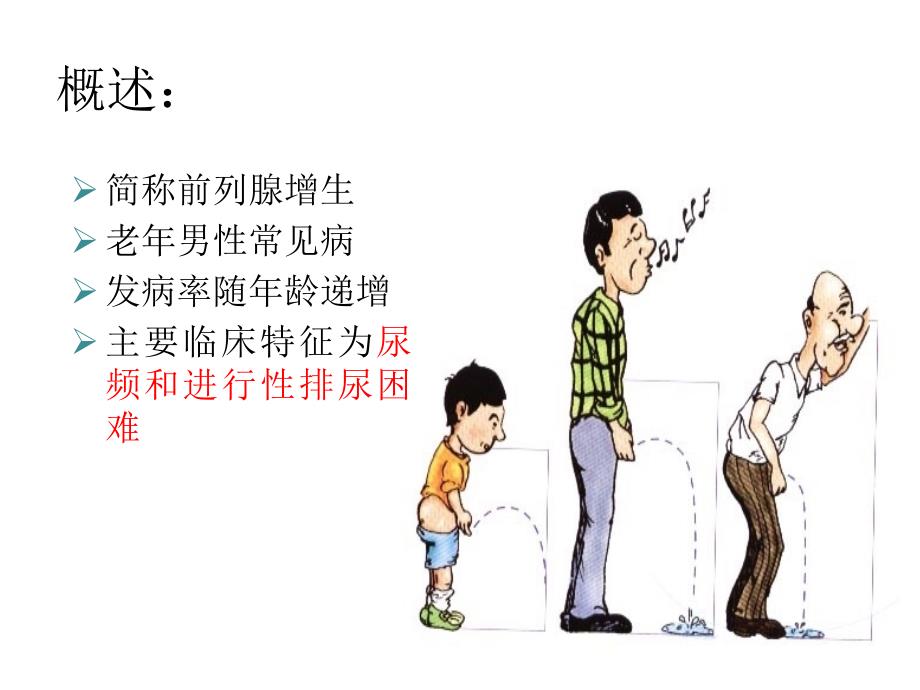 前列腺增生护理.ppt_第3页