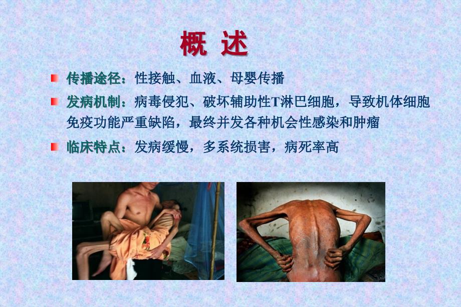 传染病学艾滋病.ppt_第3页