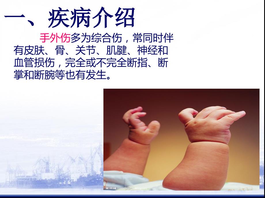 外科手外伤教学查房.ppt_第3页