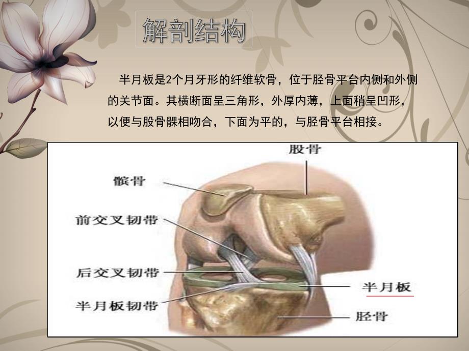 半月板损伤护理ppt课件.ppt_第3页
