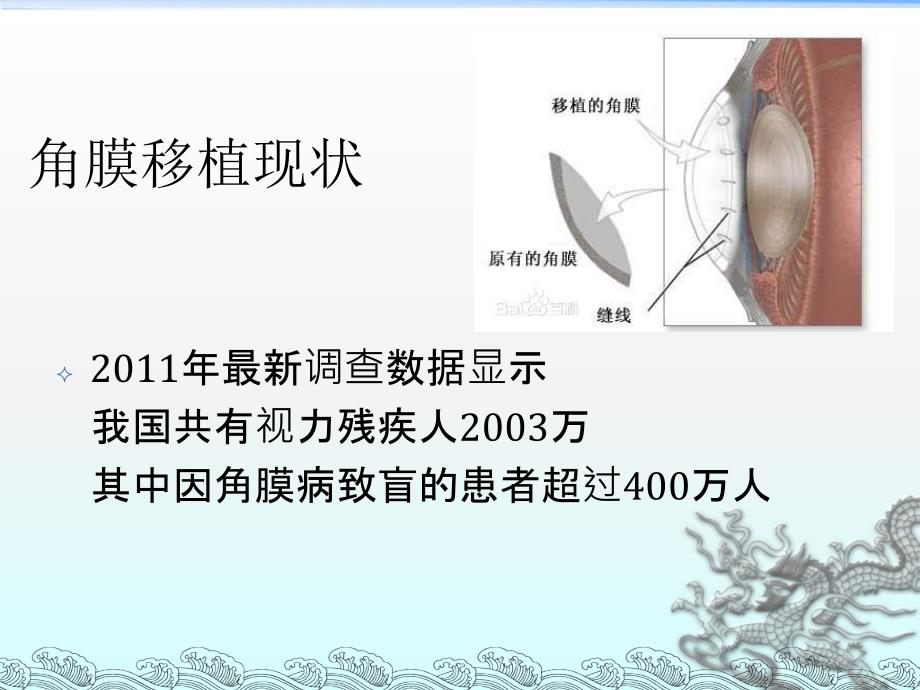 人工眼角膜PPT课件.ppt_第2页