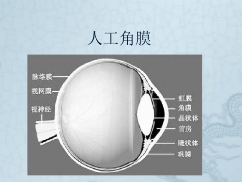 人工眼角膜PPT课件.ppt