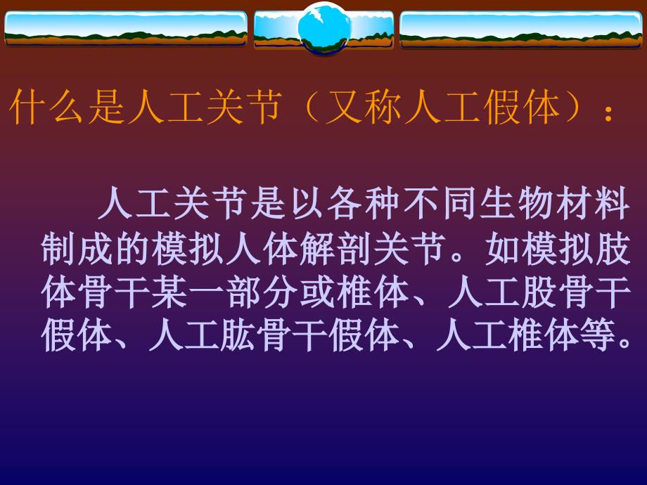 人工关节发展简史.ppt_第2页