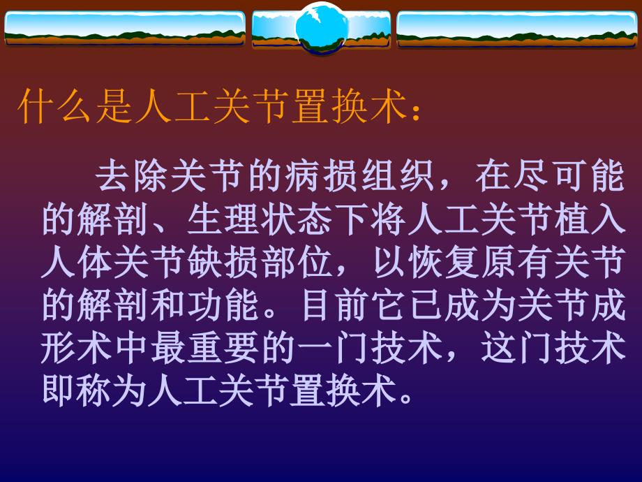 人工关节发展简史.ppt_第3页