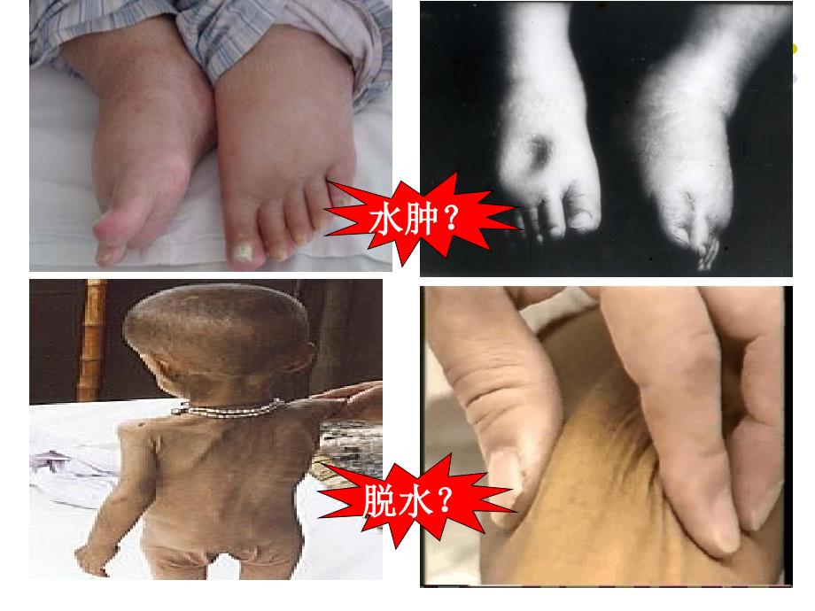 危重症酸碱平衡与水电解质紊乱ppt课件.ppt_第2页