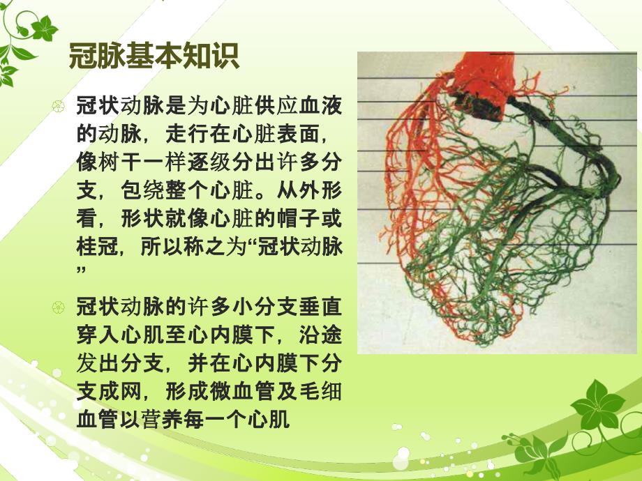 冠脉支架术及护理.ppt_第3页