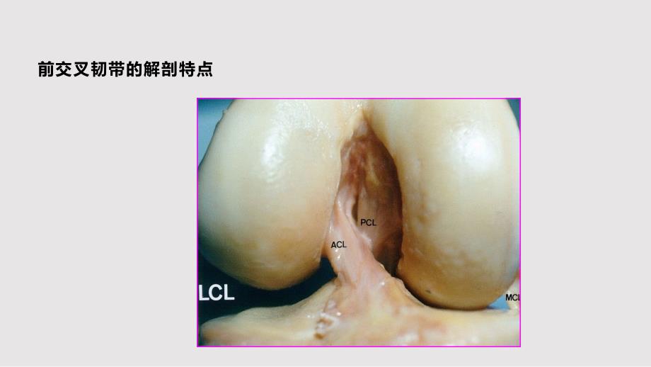 交叉韧带损伤的护理PPT课件.pptx_第3页