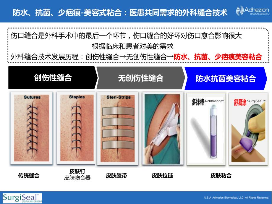 医用粘合剂产品介绍.ppt_第2页