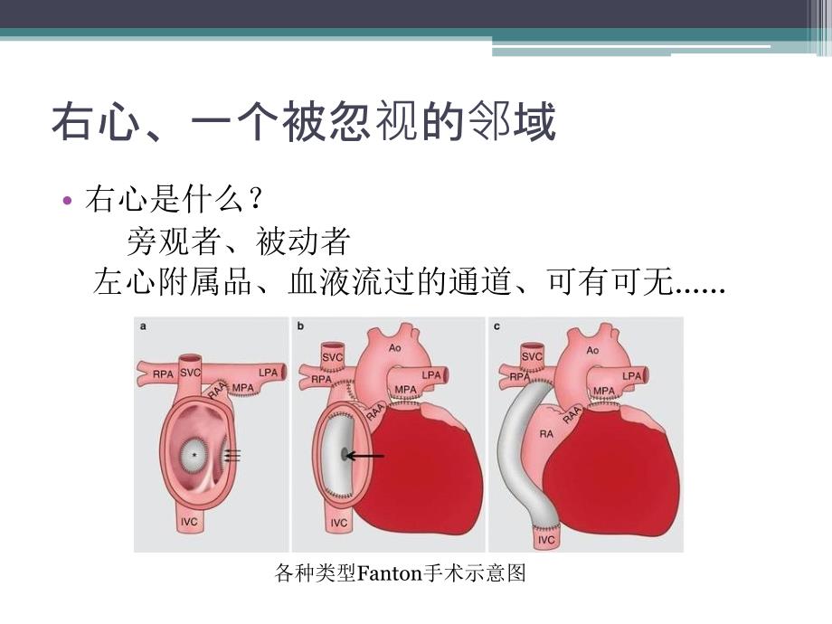 右心衰的评估和管理ppt课件.pptx_第3页