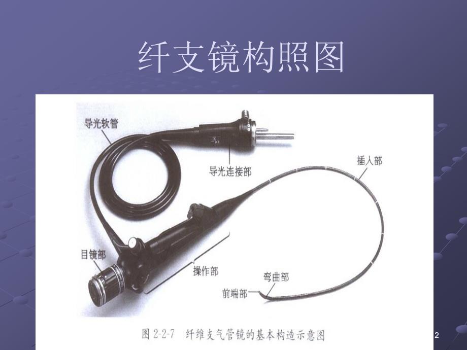 优质课件支气管镜检查演示幻灯片.ppt_第2页