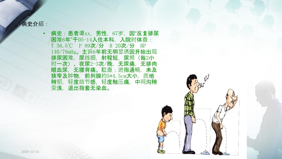 前列腺等离子电切术护理查房实用课件.ppt_第2页