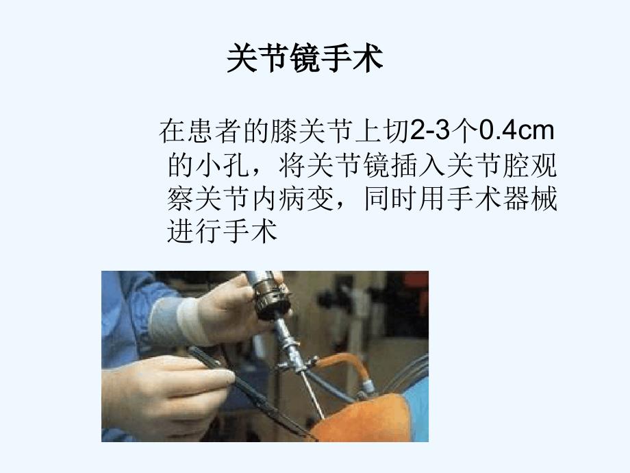 关节镜器械.ppt_第3页