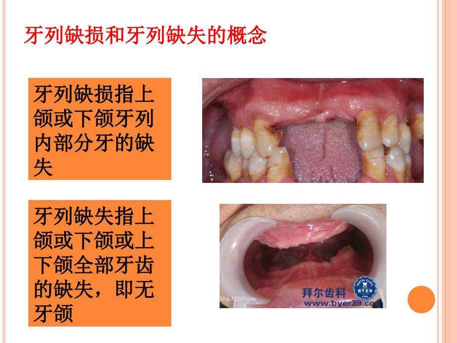 口腔修复ppt课件.ppt_第2页