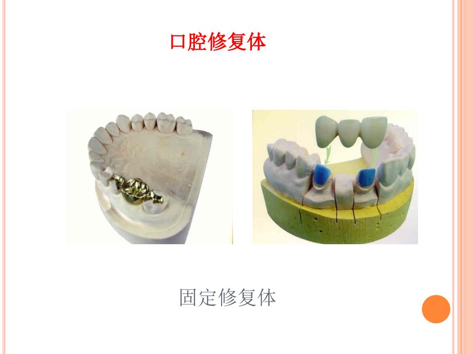 口腔修复ppt课件.ppt_第3页