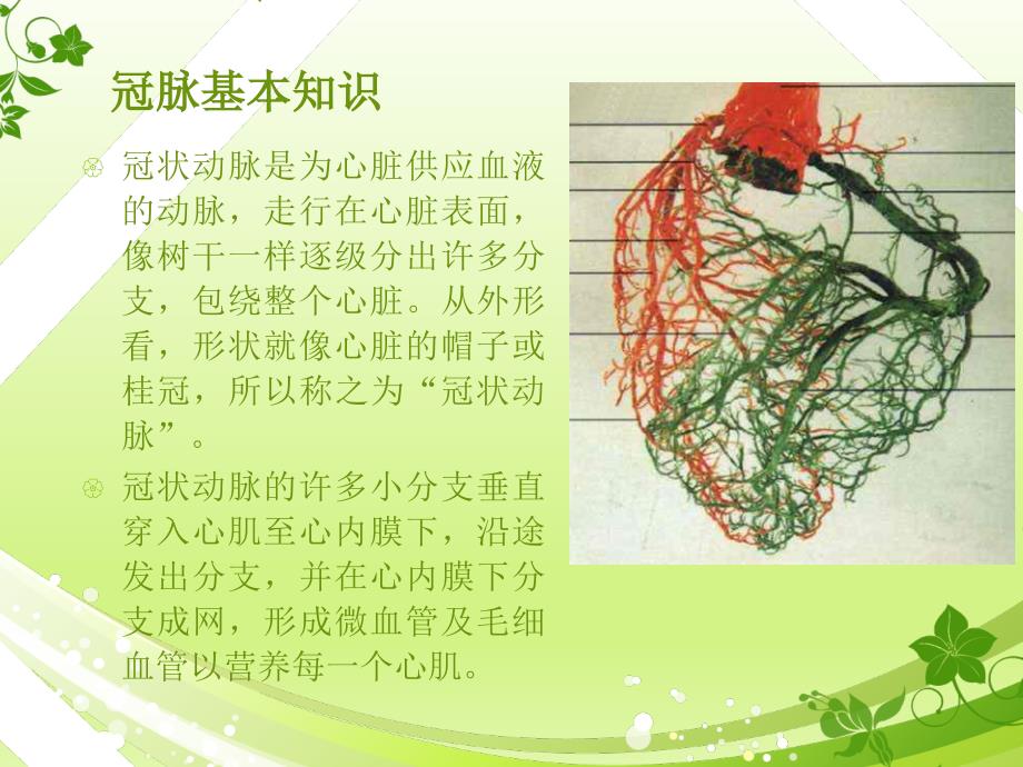 冠脉支架术及护理PPT课件.ppt_第3页
