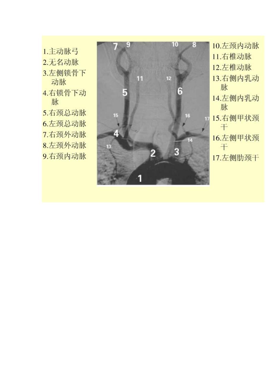 关于脑血管造影图片详解.docx_第2页