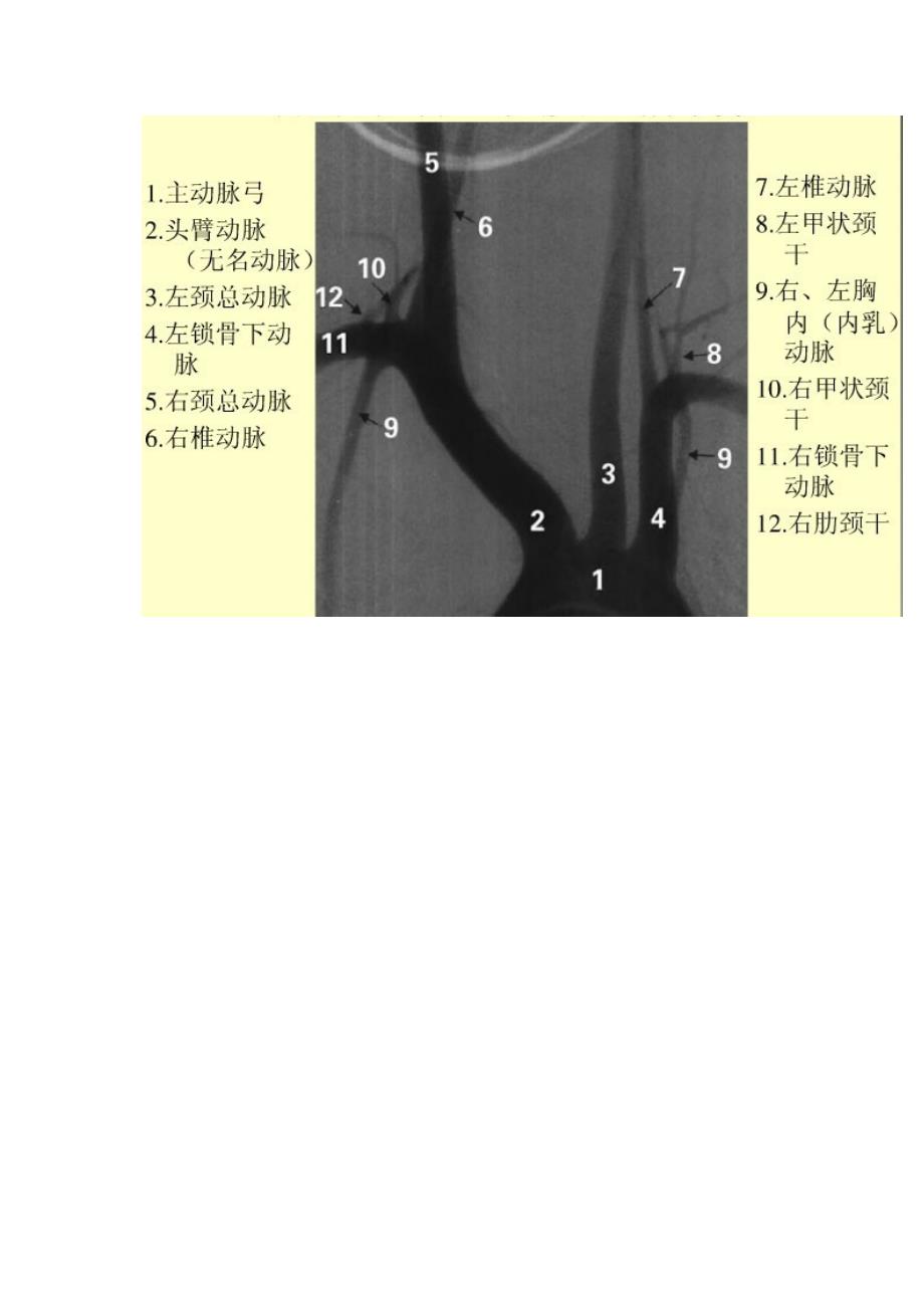 关于脑血管造影图片详解.docx_第3页