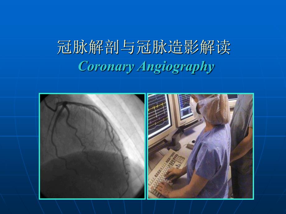 冠脉解剖与冠脉造影解读课件.ppt_第1页