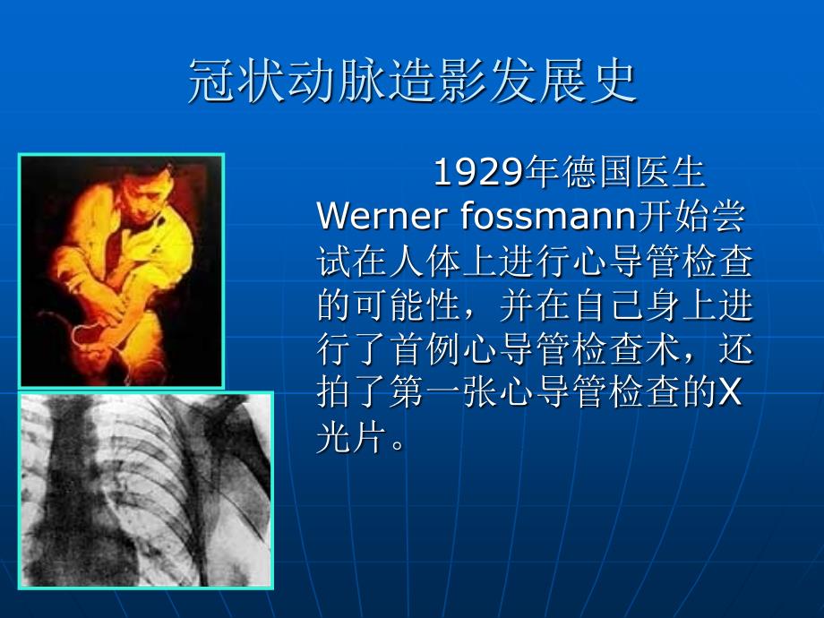 冠脉解剖与冠脉造影解读课件.ppt_第2页