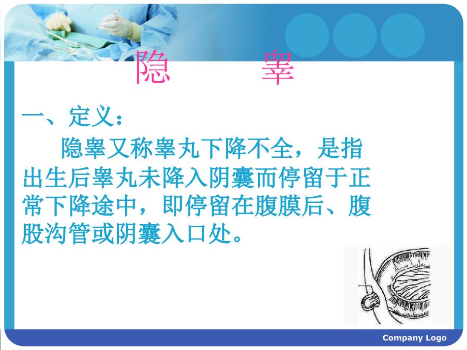 小儿隐睾PPT课件.ppt_第2页