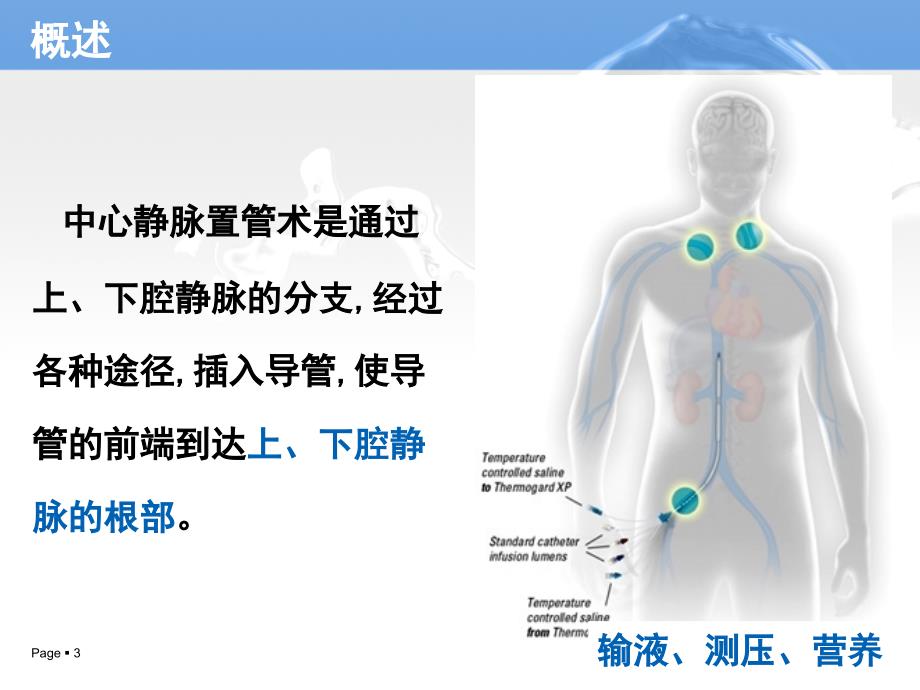 中心静脉置管术的护理ppt课件.ppt_第3页