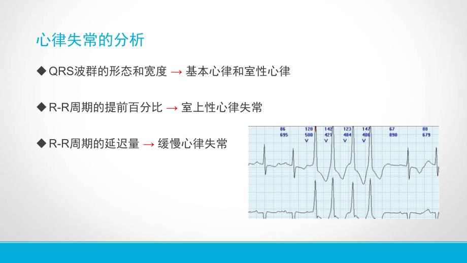 动态心电图报告解读及临床应用.pptx_第3页