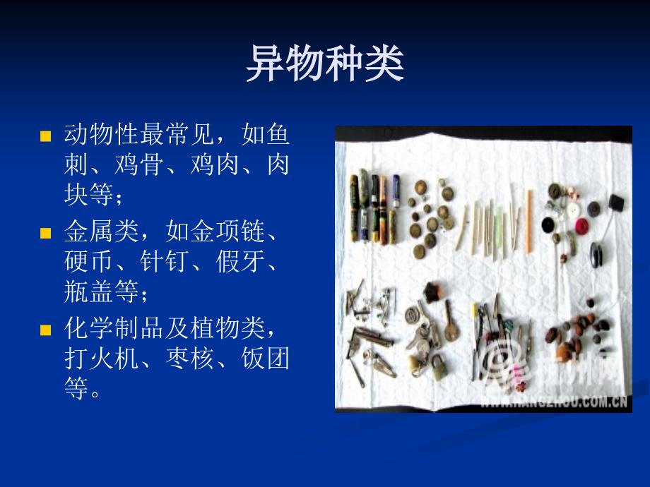 内镜下食管异物取出术ppt课件.ppt_第3页