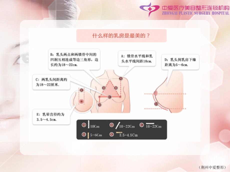 丰胸整形PPT课件.ppt_第2页