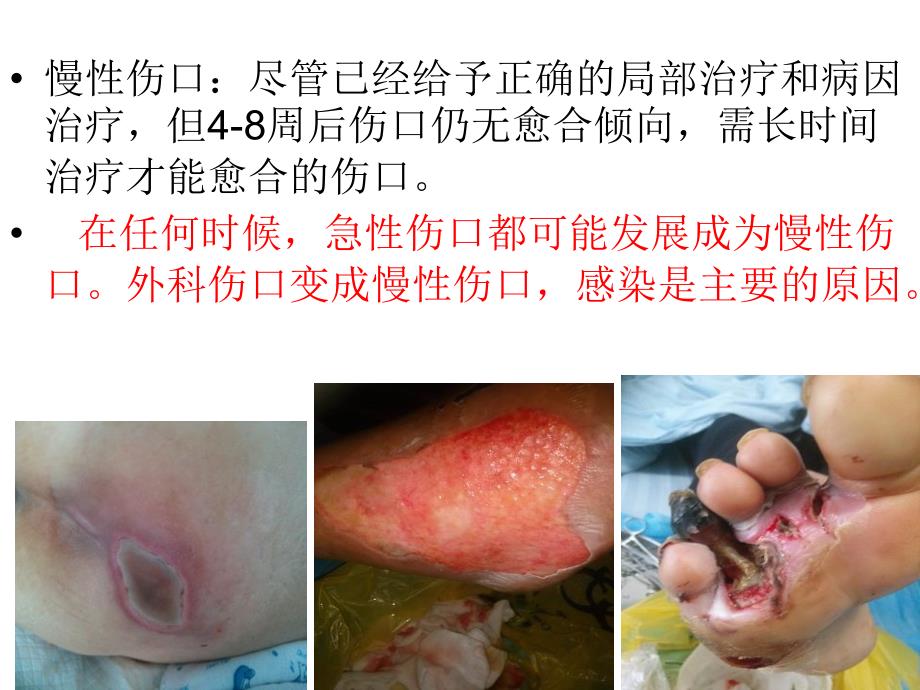 伤口管理PPT课件.ppt_第3页