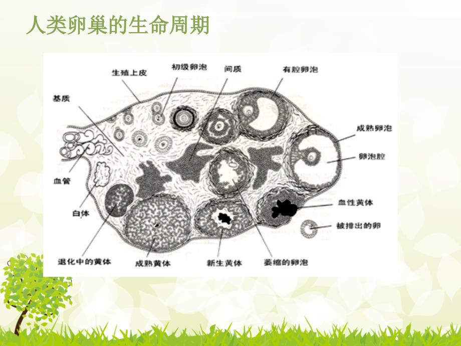 卵巢黄体破裂出血护理查房.ppt_第3页